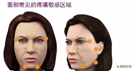 面部以神经点,敏感点,骨头,下颚骨,下巴,脖子等为常见的疼痛敏感区.