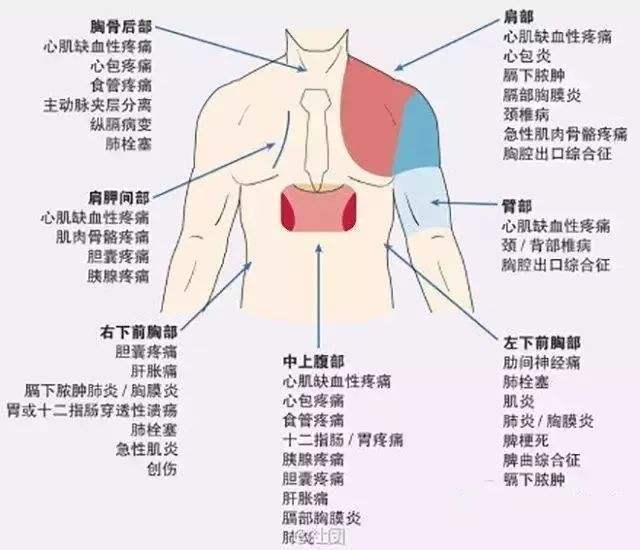肺癌胸痛的位置图片