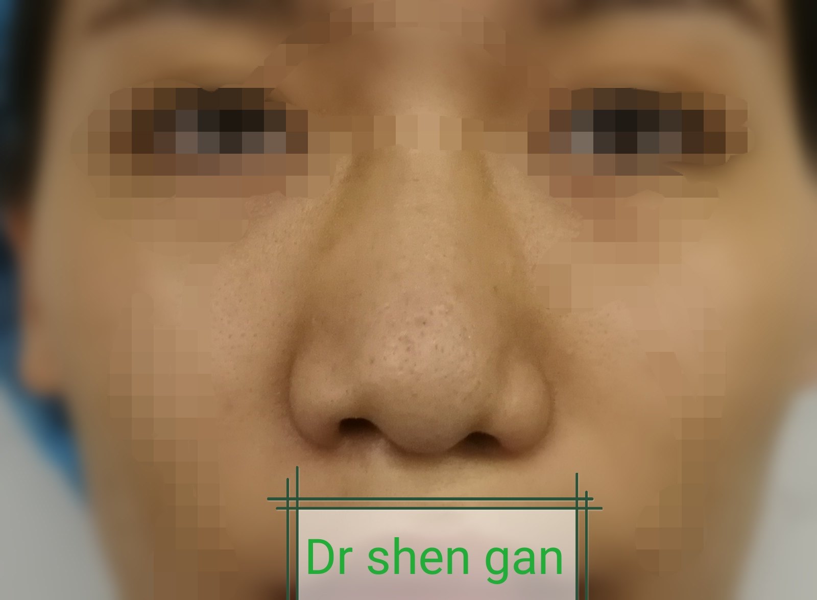 暂无