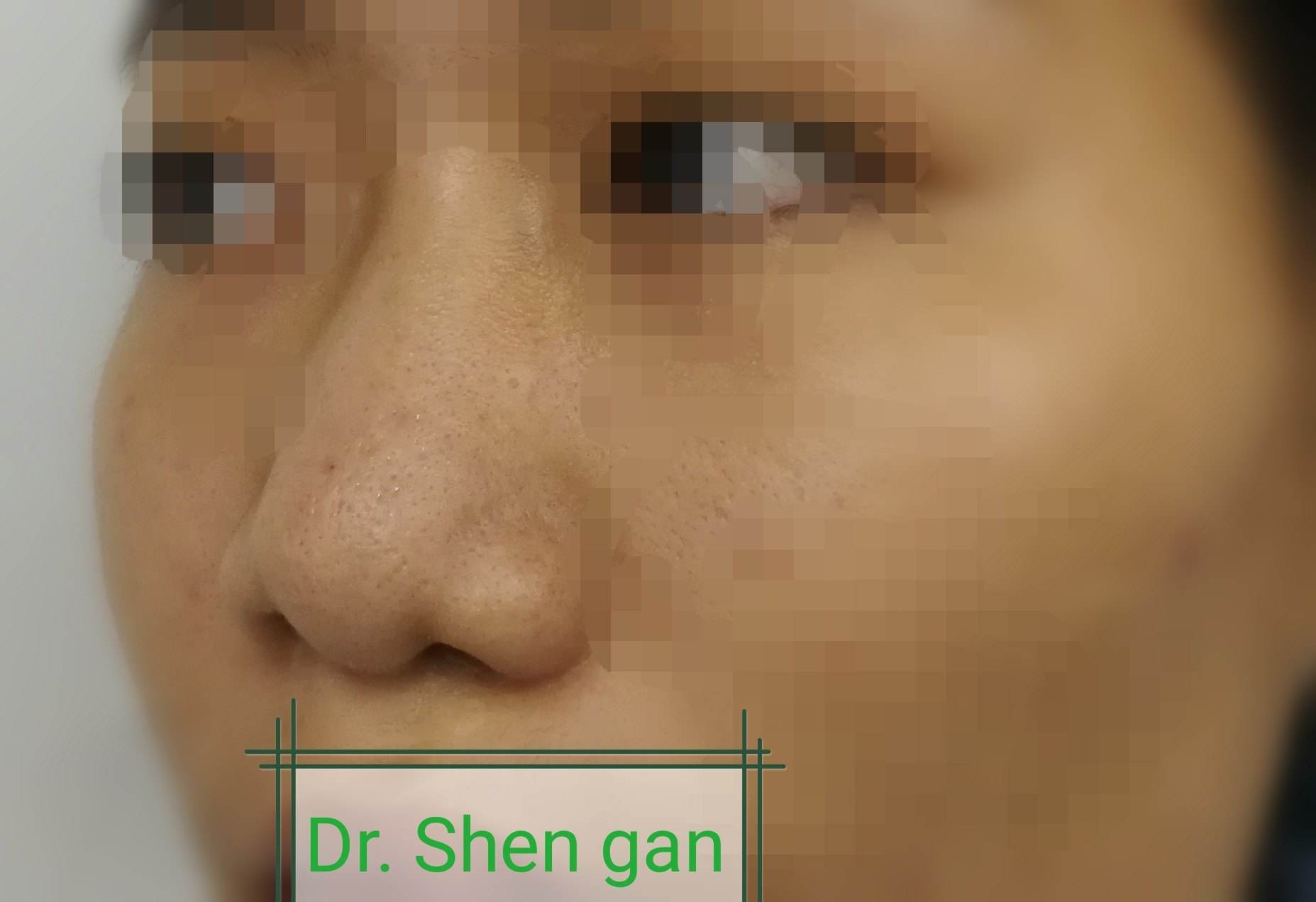 暂无