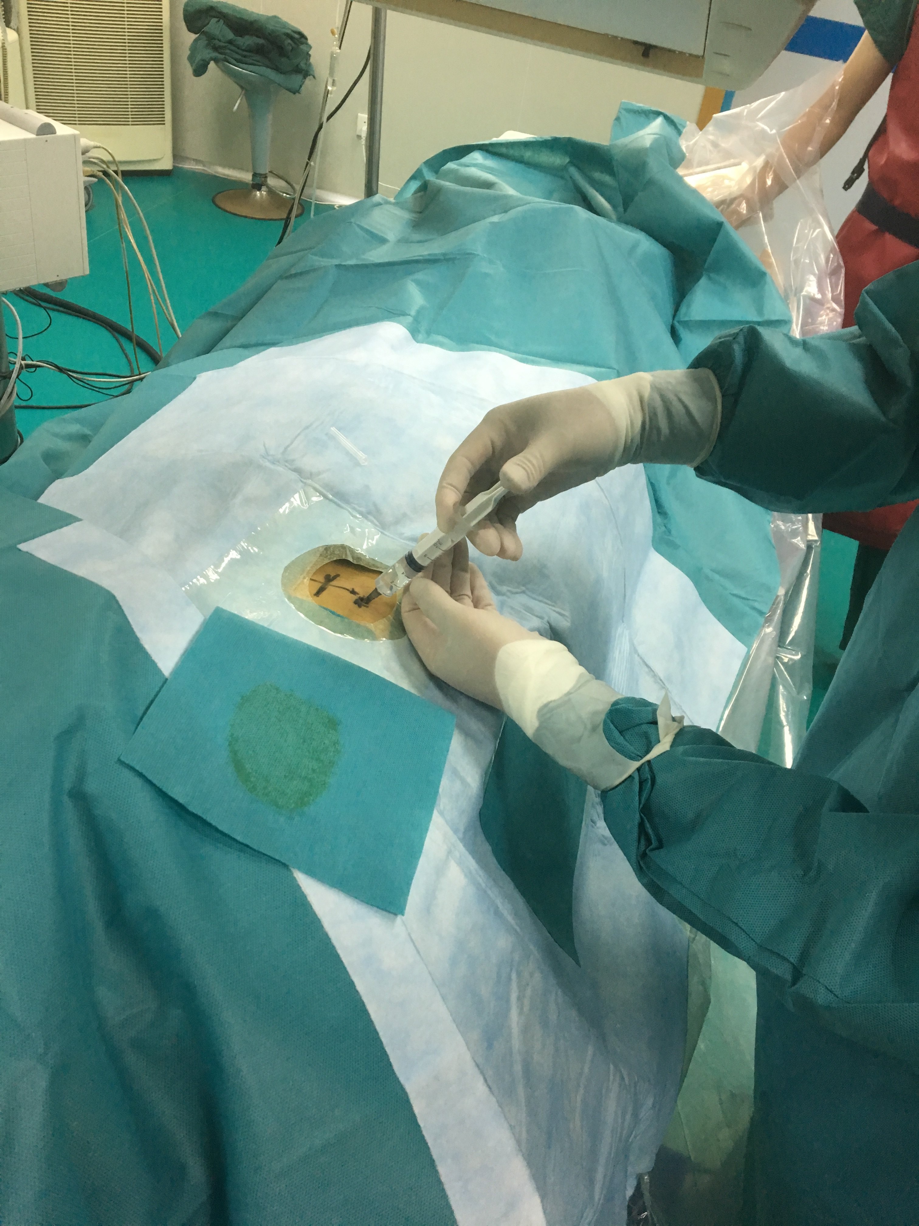 水泥也能治疗骨折? - 好大夫在线