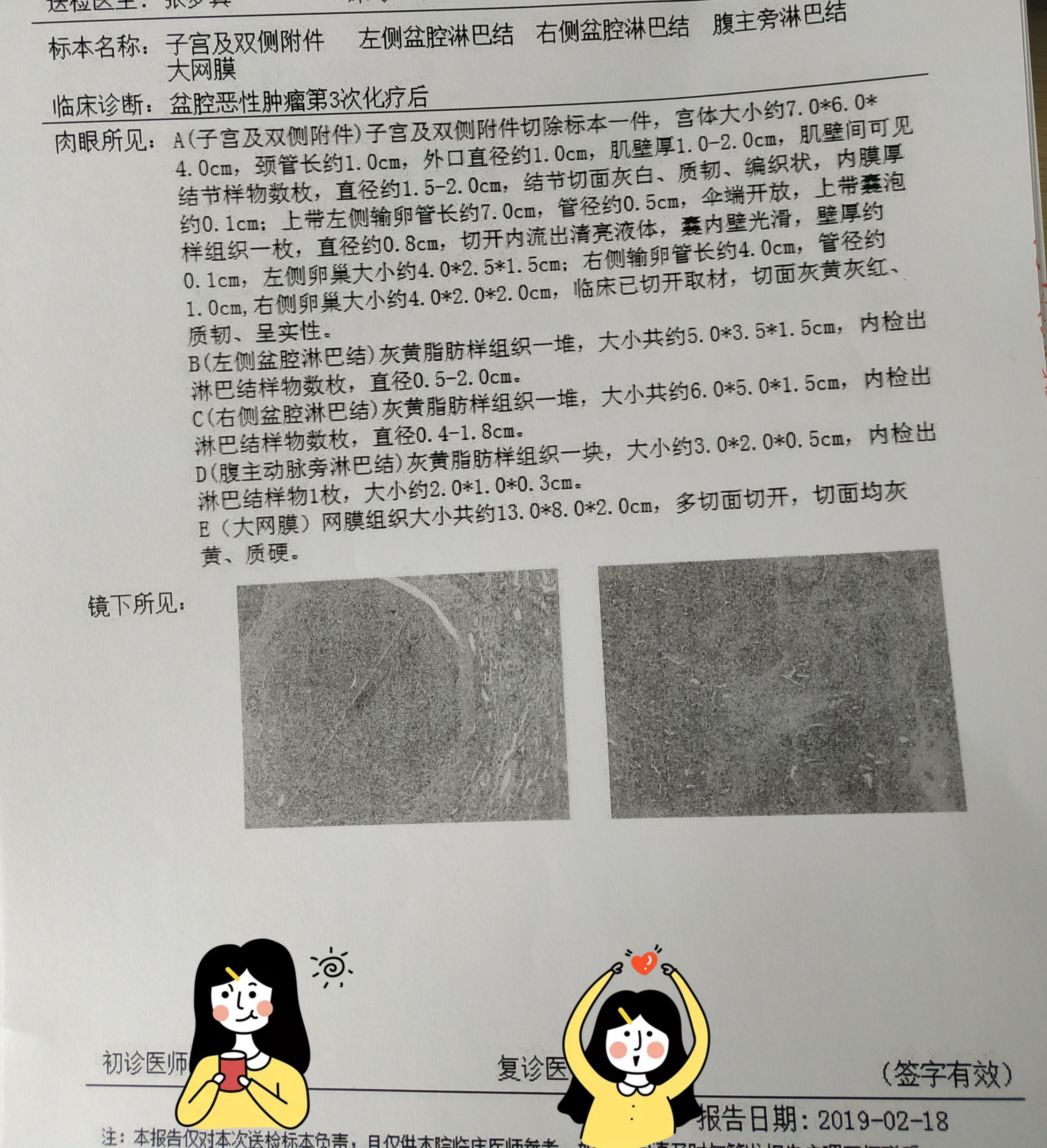 灸藥合用治療原發耐藥卵巢癌腹水一例