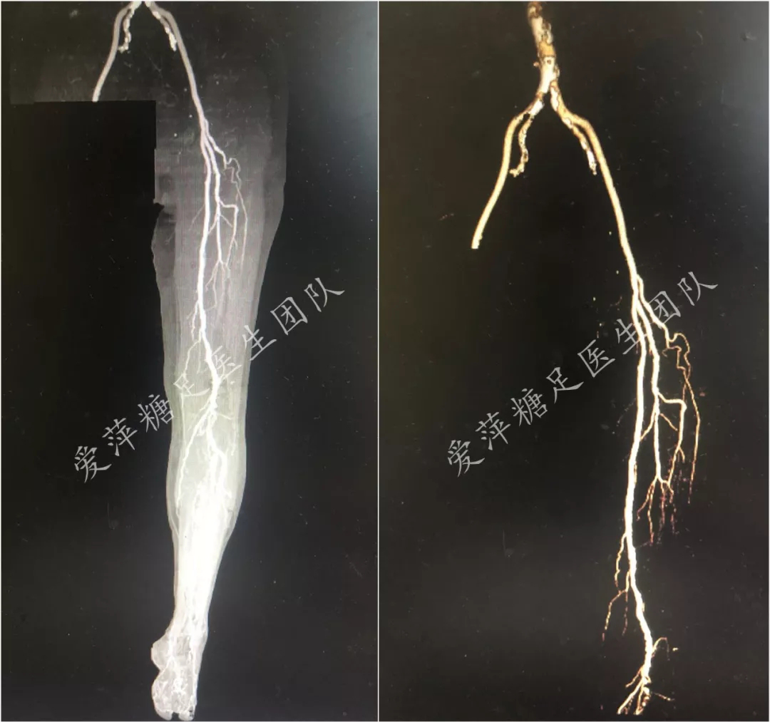 膝盖出现黑色斑块图片