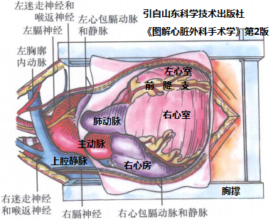 上圖為指示心臟與切口關係的透視圖.上圖為前胸正中切口的示意圖.