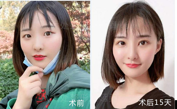 包含八大处整型医院黄牛加号说到必须做到的词条 包含八大处整型医院黄牛加号说到必须做到的词条