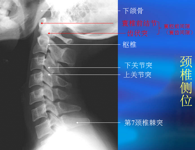最科学的颈椎病自我康复训练 每天10分钟 远离颈椎病 颈椎病 日常护理 康复 治疗方法 最科学的颈椎病自我康复训练 每天10分钟 远离颈椎病 颈椎病 日常护理 康复 治疗方法