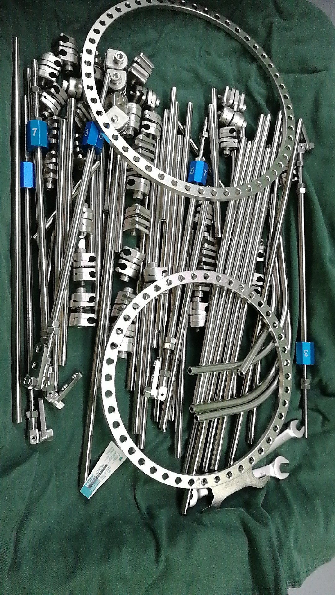 重度脊柱侧弯头盆环外固定牵引时需要有耐心