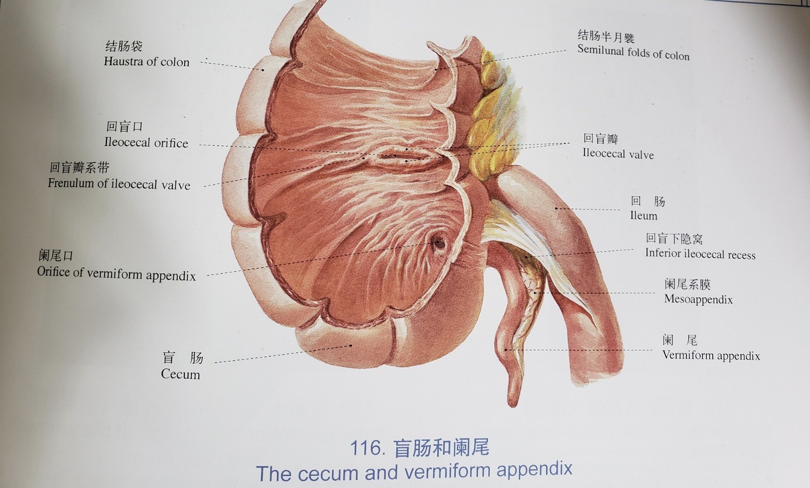 正常的阑尾该切吗