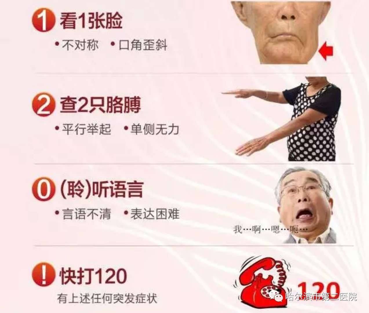 脑梗死临床表现图片