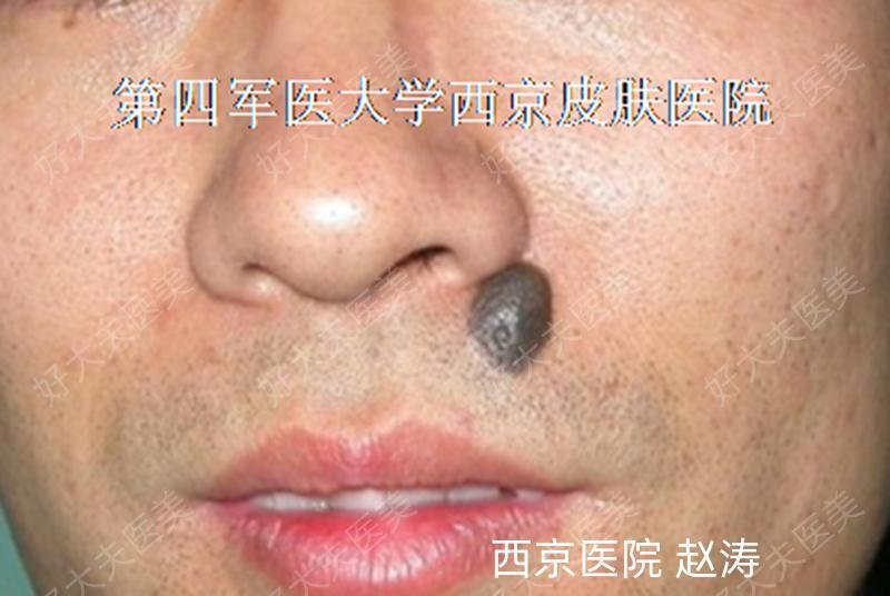 圖文圖片