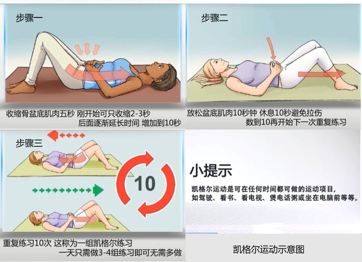 提高性能力的锻炼方法 凯格尔运动 性功能障碍 好大夫在线
