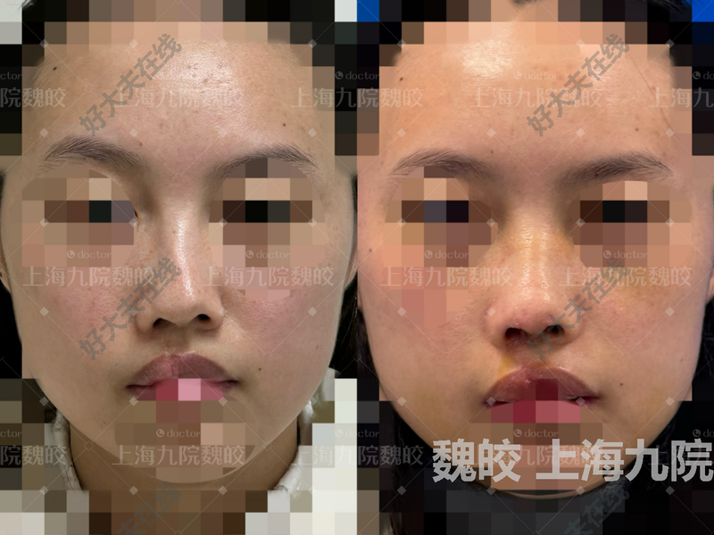 圖文圖片