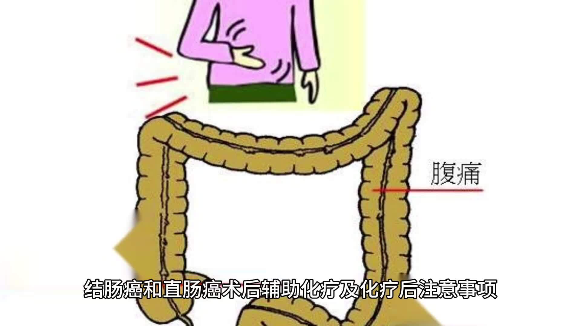 視頻封面