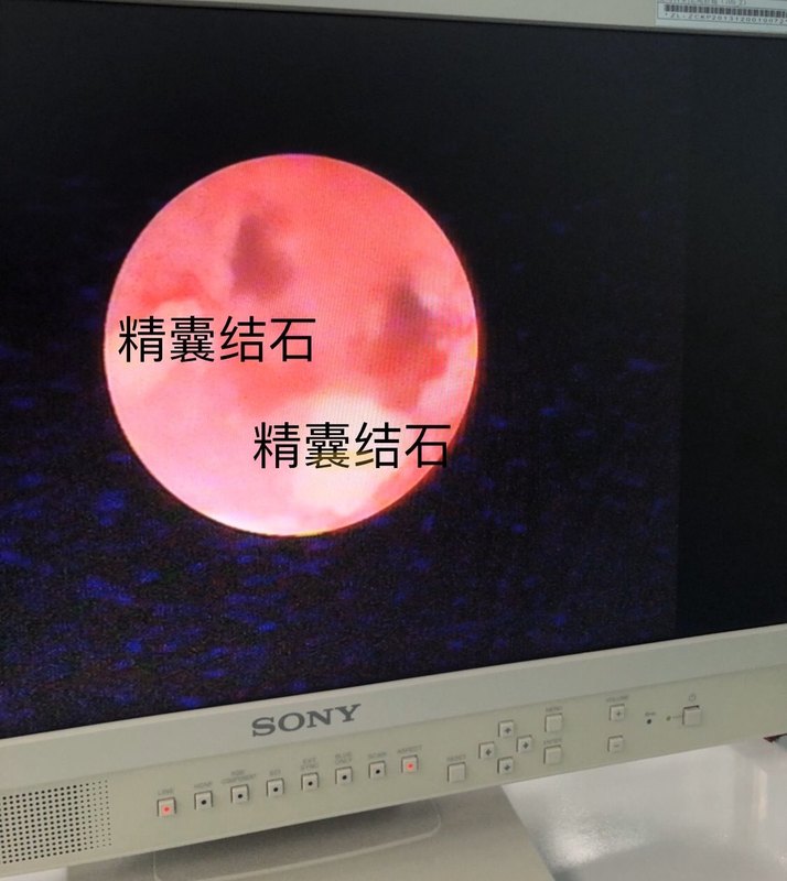 圖文圖片