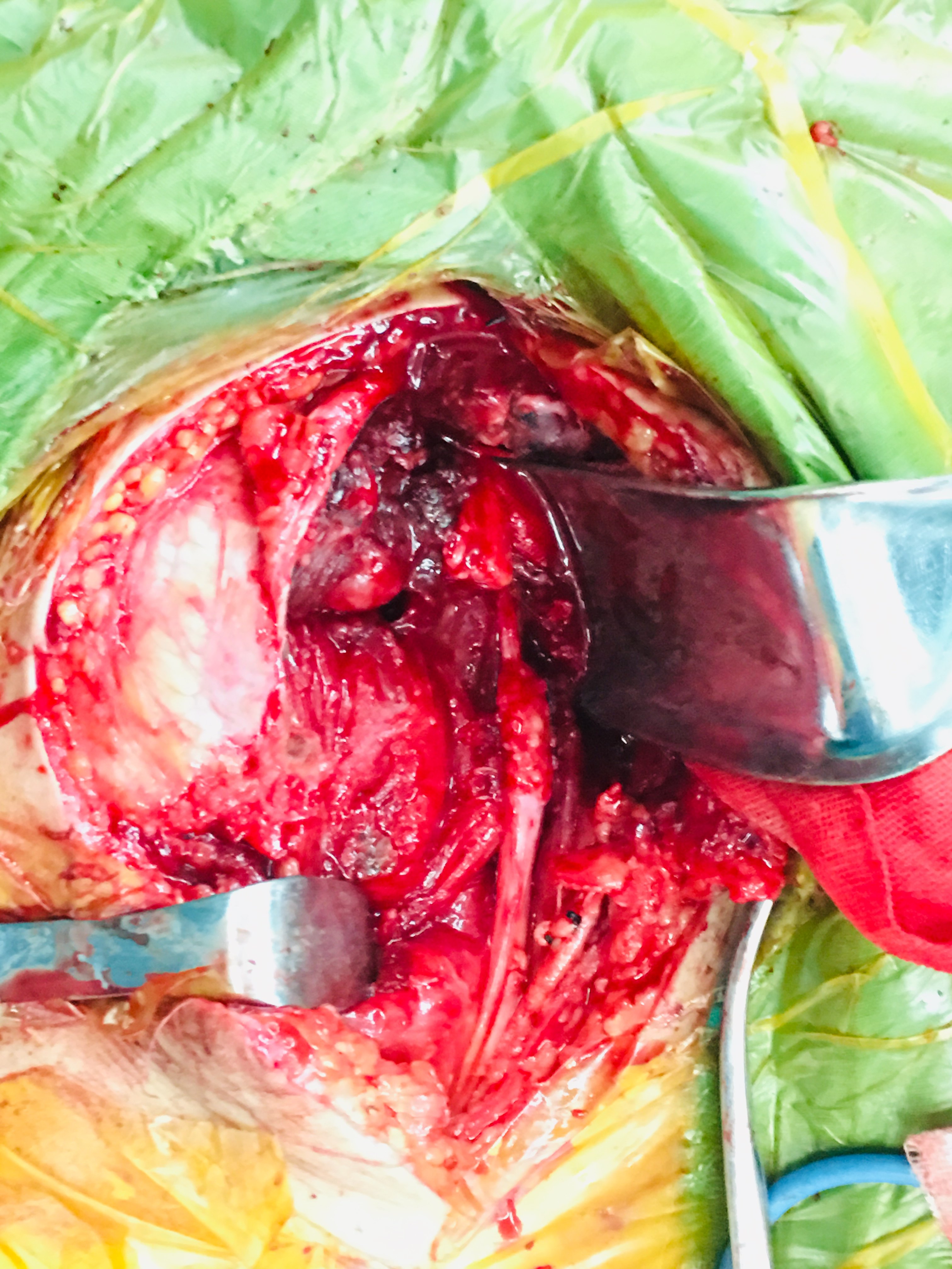 股神经损伤 - 好大夫在线