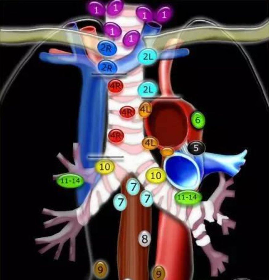肺癌淋巴结转移就不能手术吗? - 好大夫在线