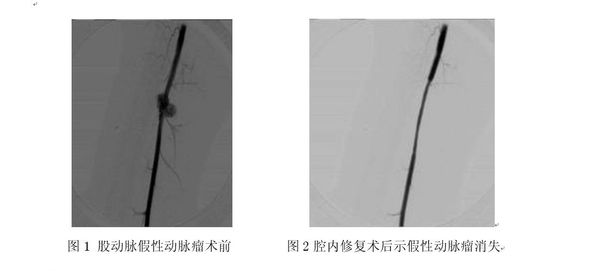 下肢血管损伤的诊治 - 好大夫在线