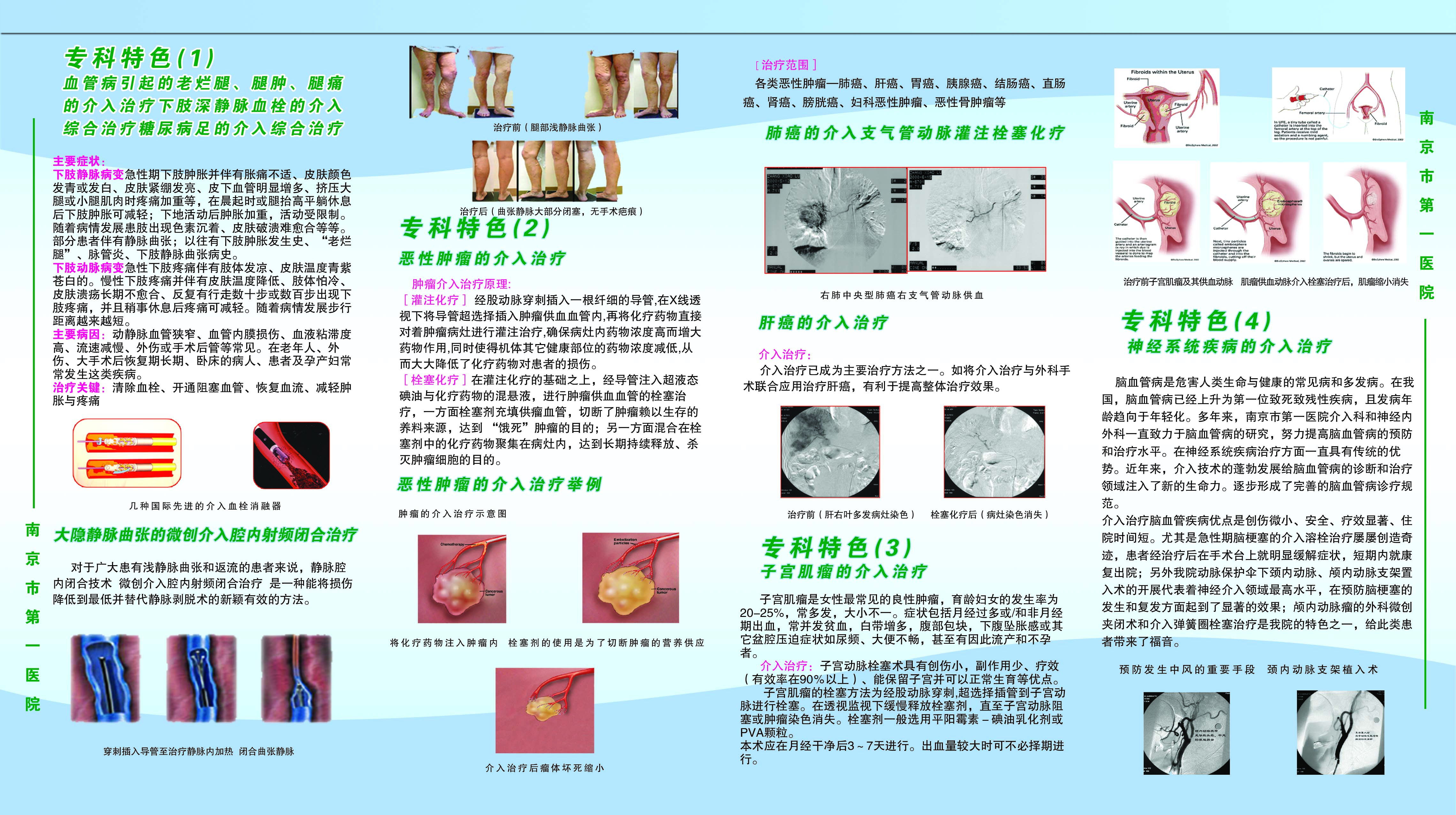 介入治疗健康宣教图片图片