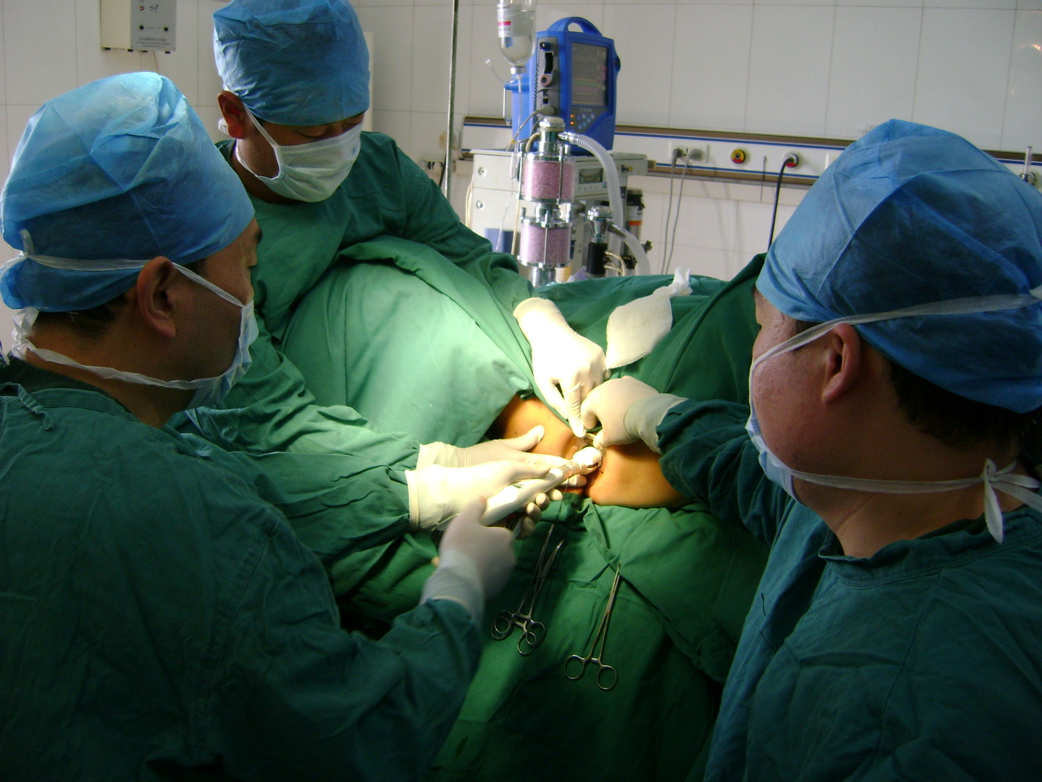 好大夫在线 王昱晟 > pphpph 手术原理 •     " 断流" 切断位于