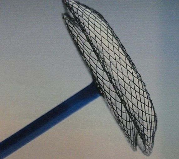 amplatzer双面伞房间隔封堵器是一自膨胀双伞镍钛合金金属网