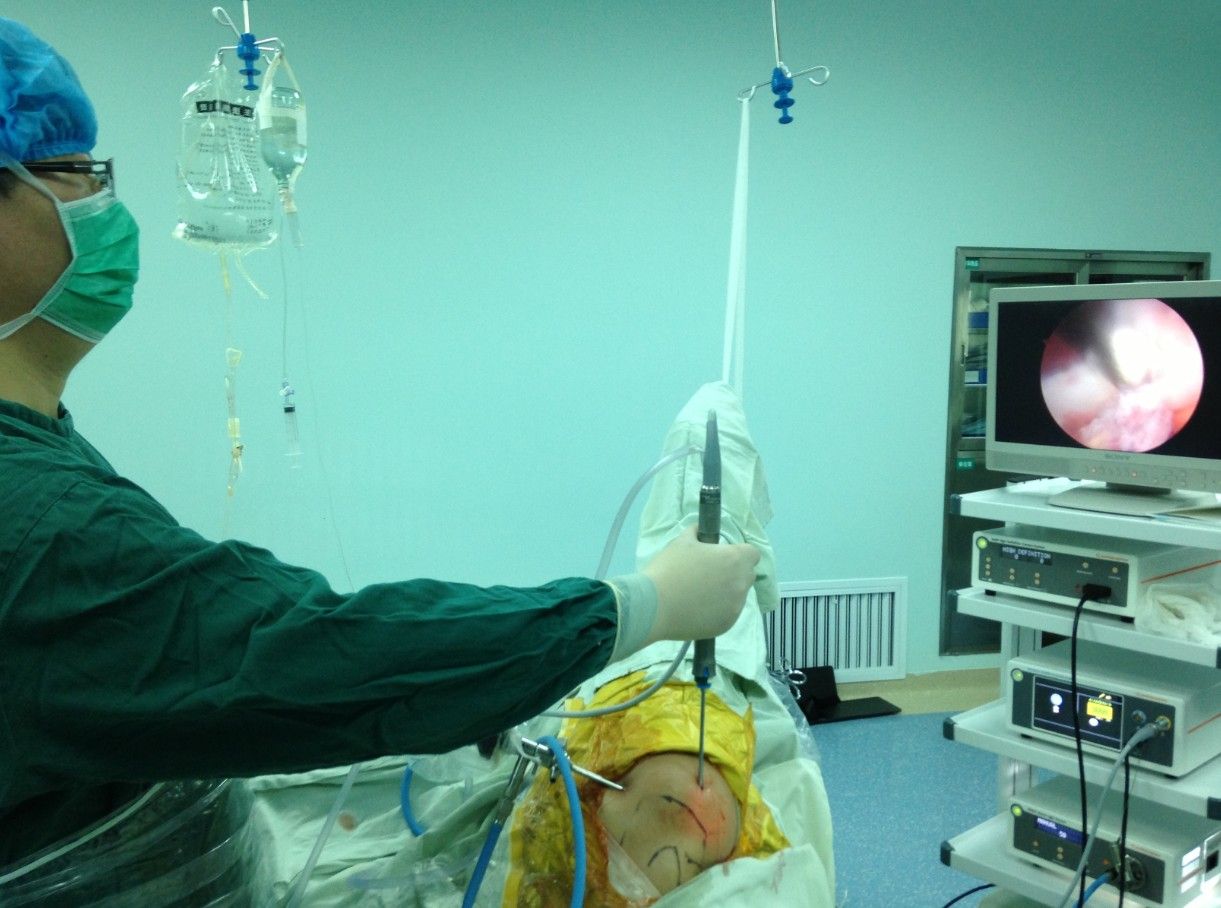 肩关节镜微创肩峰成形手术治疗肩峰撞击综合征