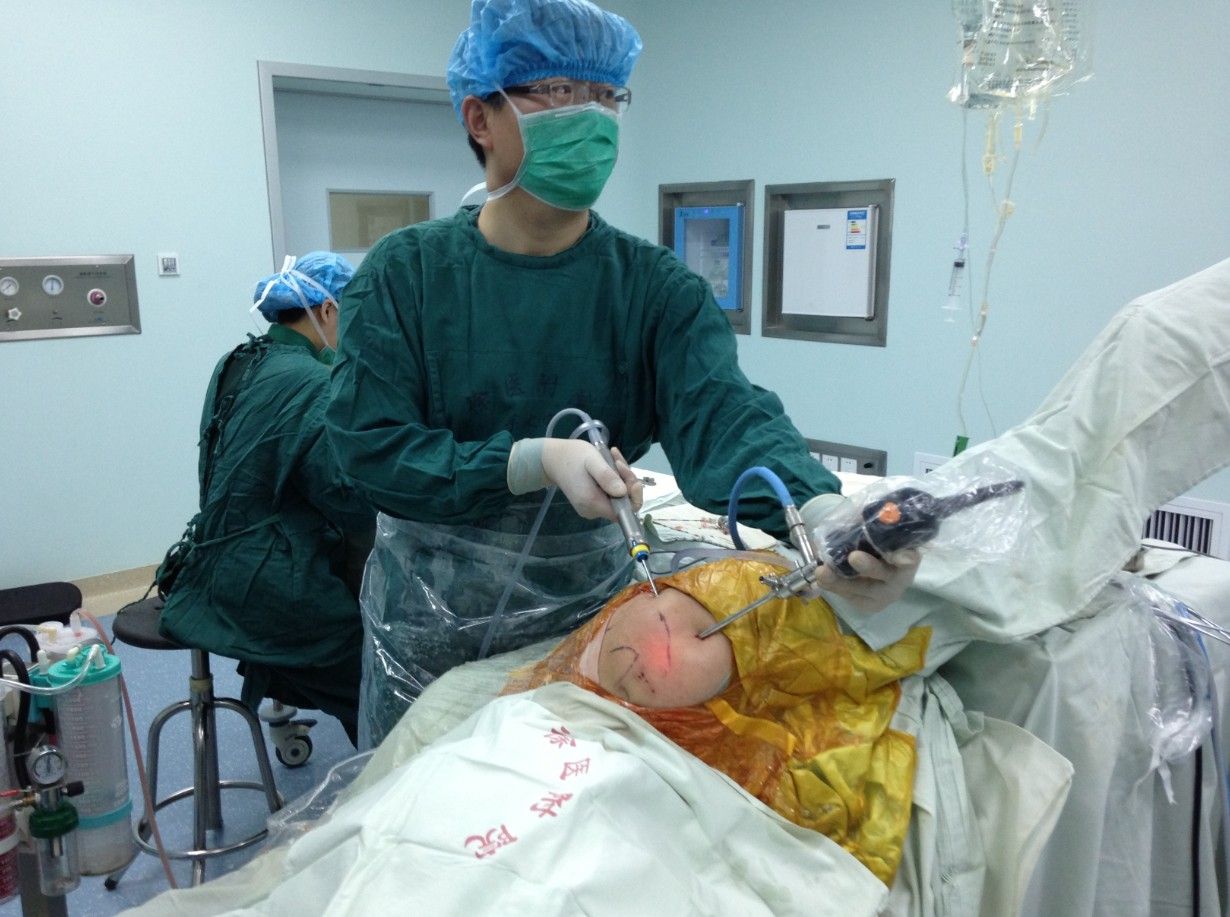 肩关节镜微创肩峰成形手术治疗肩峰撞击综合征