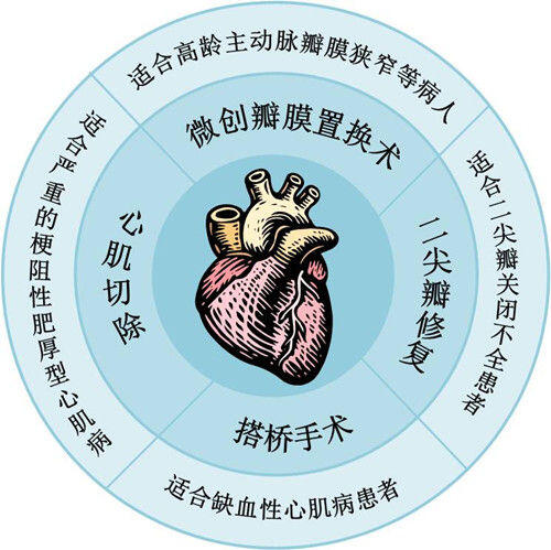 心臟功能減低患者已經不是外科手術的禁區,像 冠狀動脈搭橋 技術,瓣膜