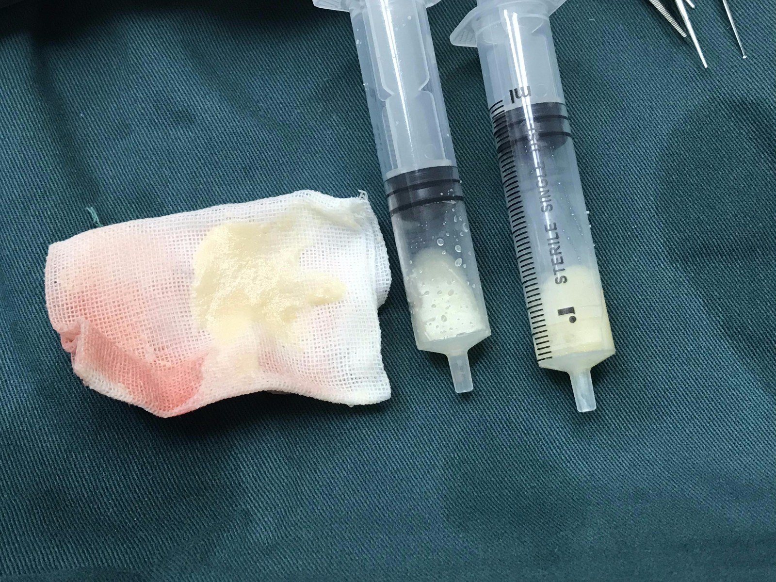 【科普】注射物修复之:生长因子 - 好大夫在线