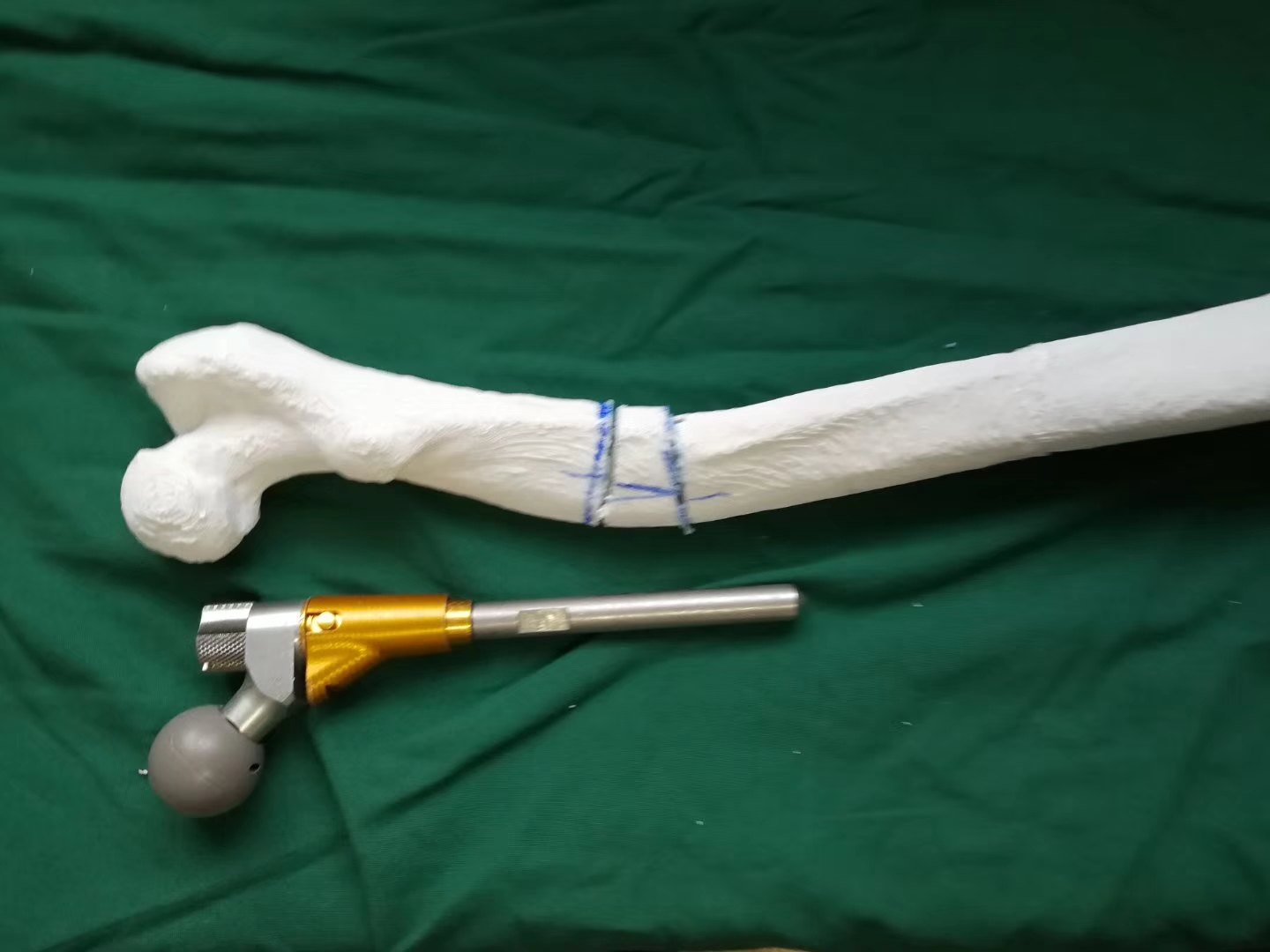 包含擅长:成人发育性髋关节发育不良、DDH人工关节置换术、运动医学。票贩子挂号推荐,用过的都说好的词条 包含擅长:成人发育性髋关节发育不良、DDH人工关节置换术、运动医学。票贩子挂号推荐,用过的都说好的词条