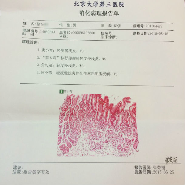 膏方治疗萎缩性胃炎患者的胃镜病理前后对照图片