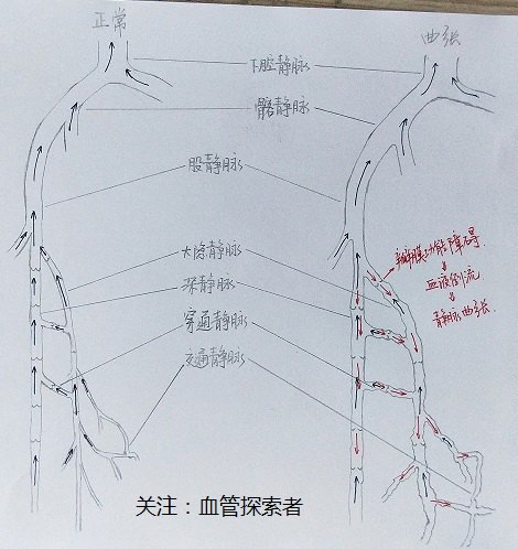 脉管系统绘图图片