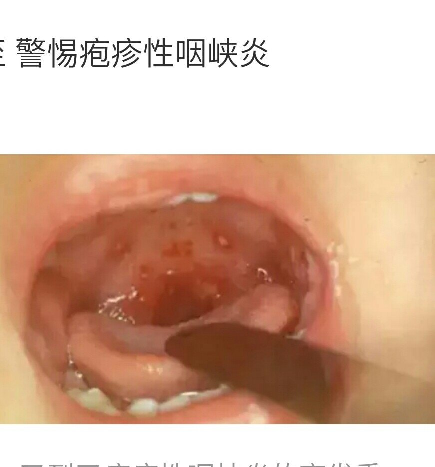 暂无