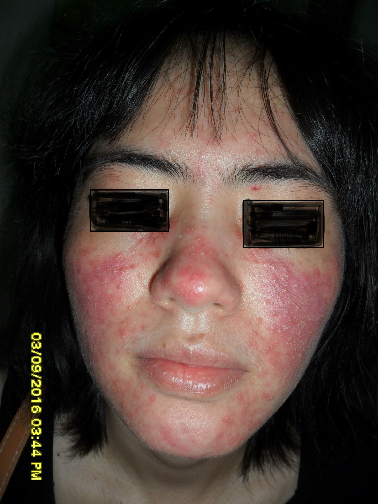 皮肤疾病,让广大患者了解它,避免它.