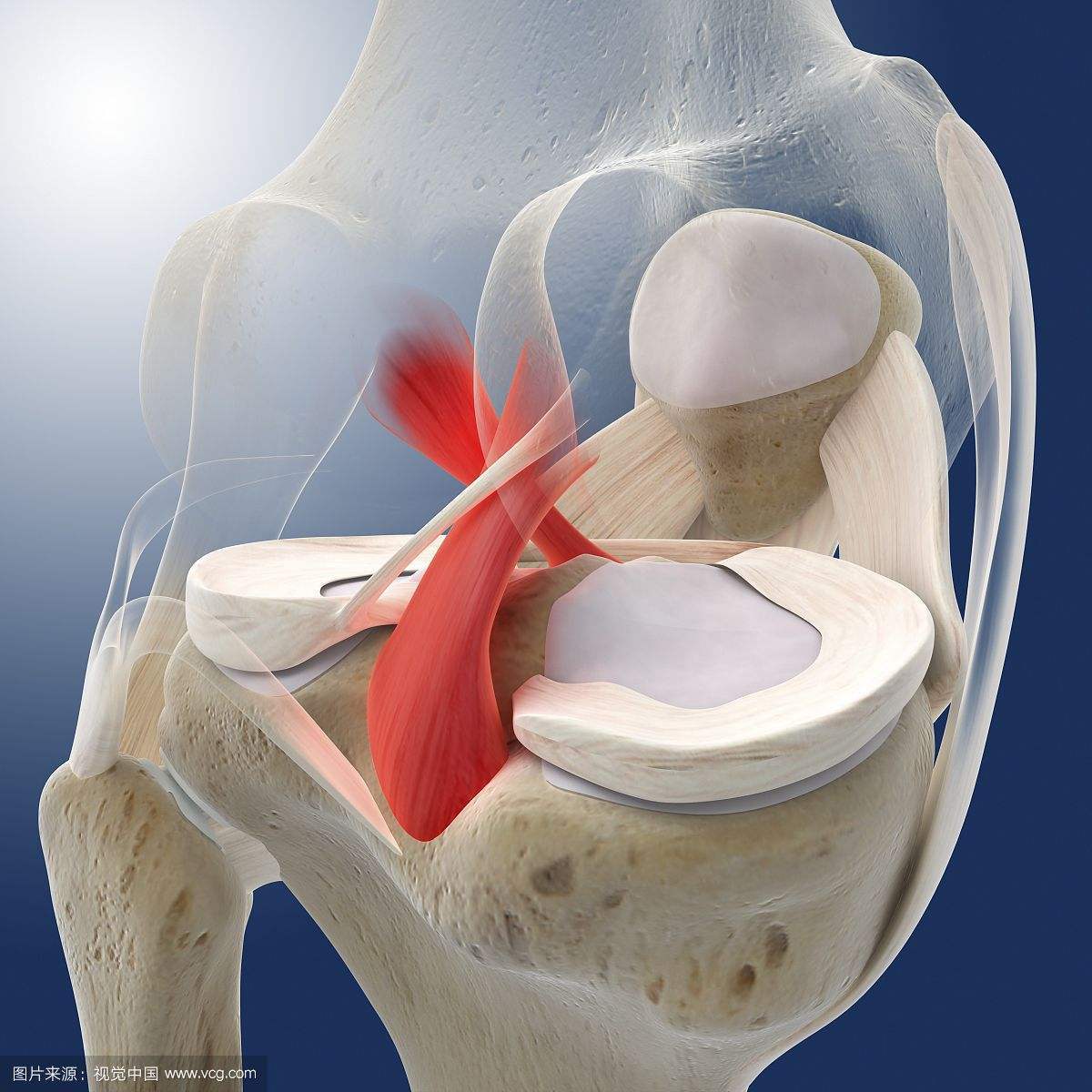 后交叉韧带(pcl)与前交叉韧带(acl)一样,是位于关节内,滑膜囊外的结构