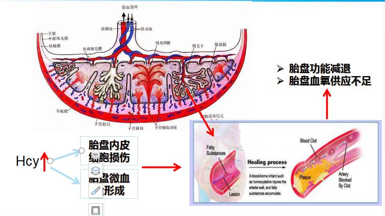 5,胎盘功能与妊娠期疾病6,同型半胱氨酸与fgr7,胎盘功能与妊娠期疾病8