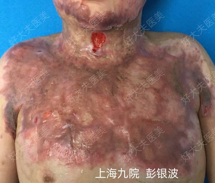 圖文圖片