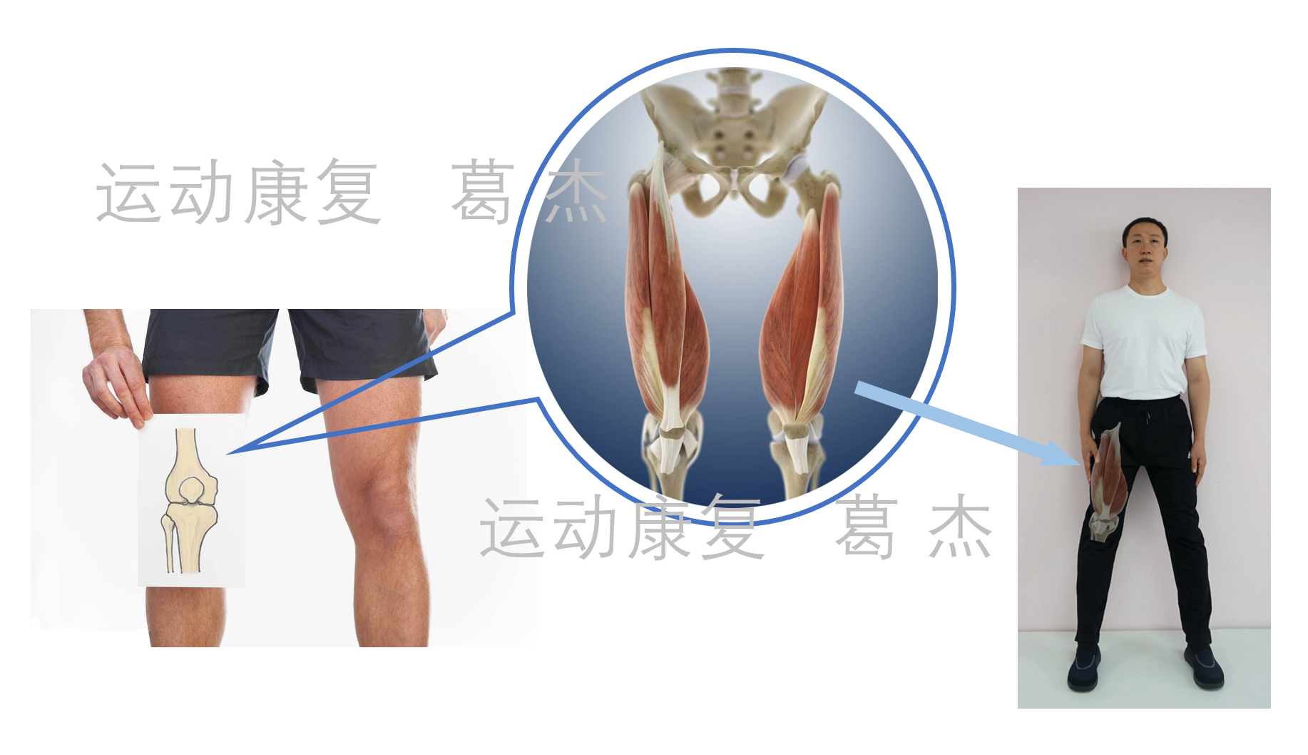 股四头肌膝关节示图.png
