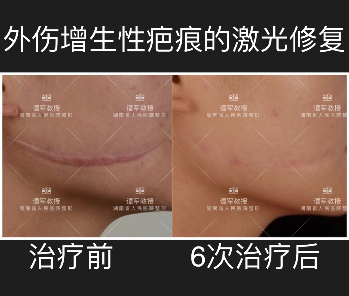 暂无