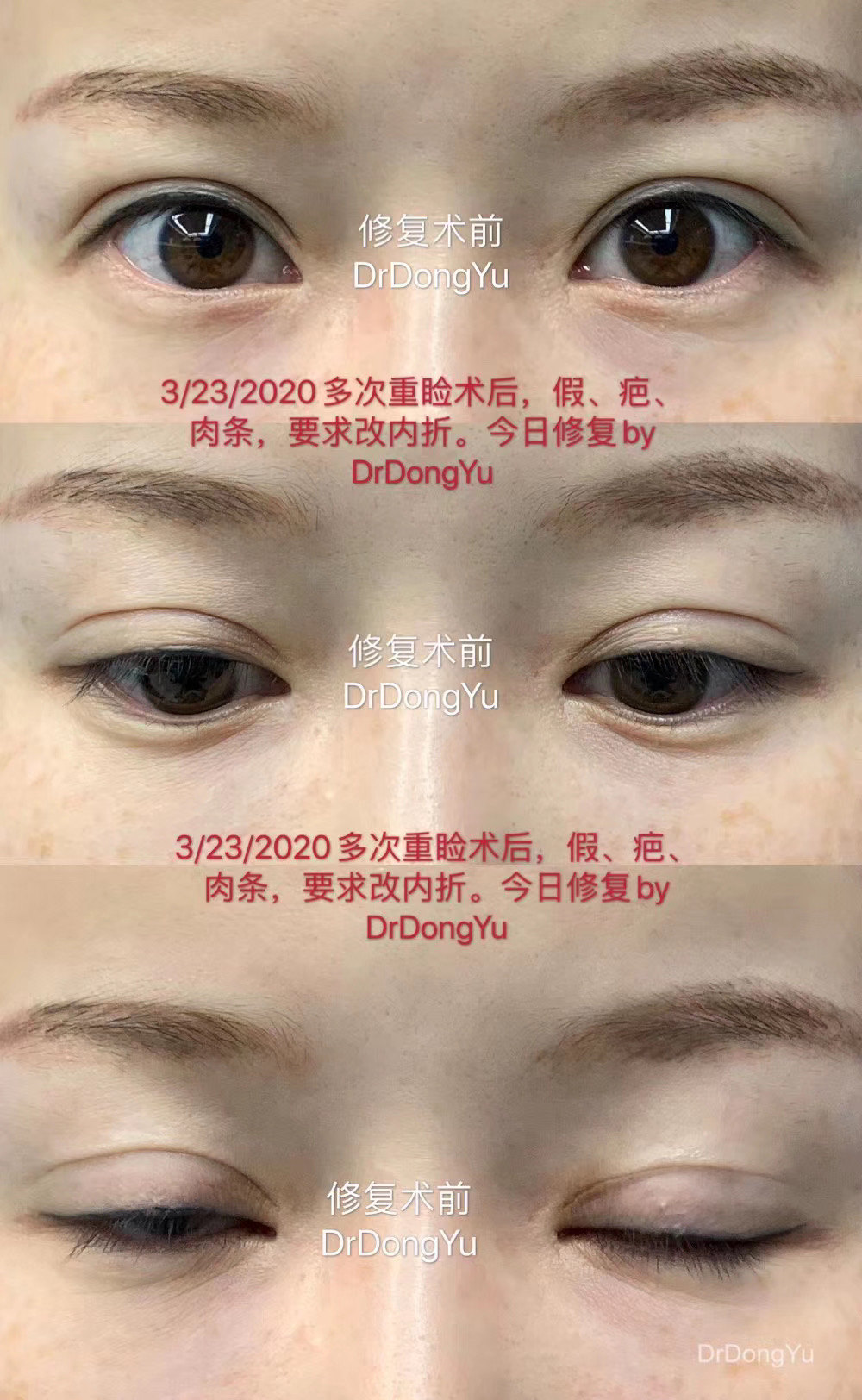暂无