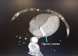 1574391524254939.png image.png