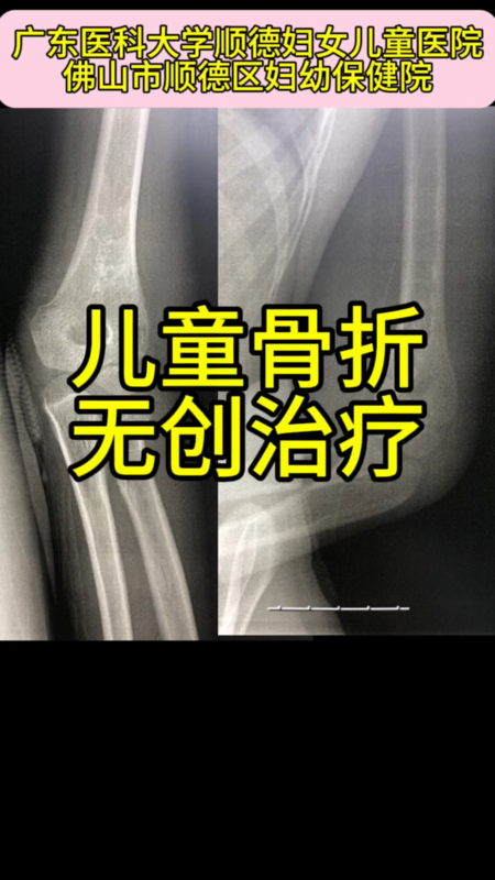 圖文圖片