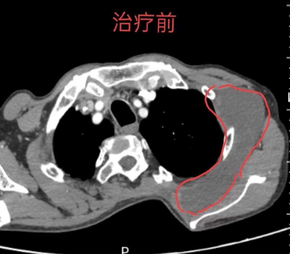 圖文圖片