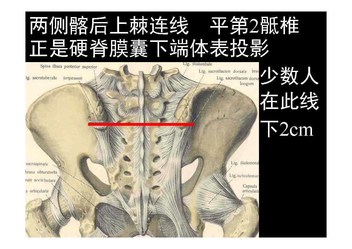 脊椎源性疼痛解剖椎管內容物