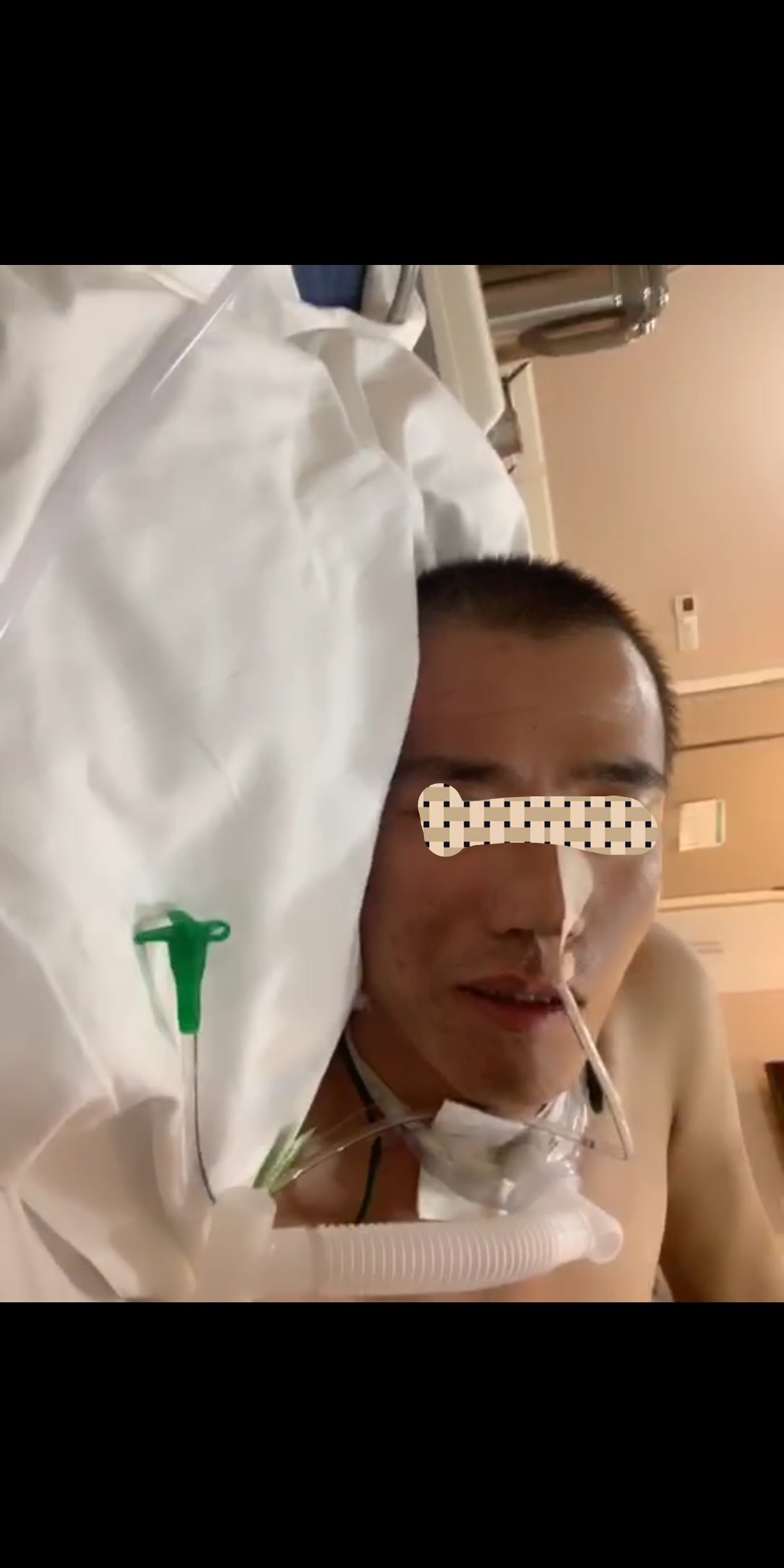 缺血缺氧性脑病昏迷,我们就两次治疗患者能够达到有意识的效果.