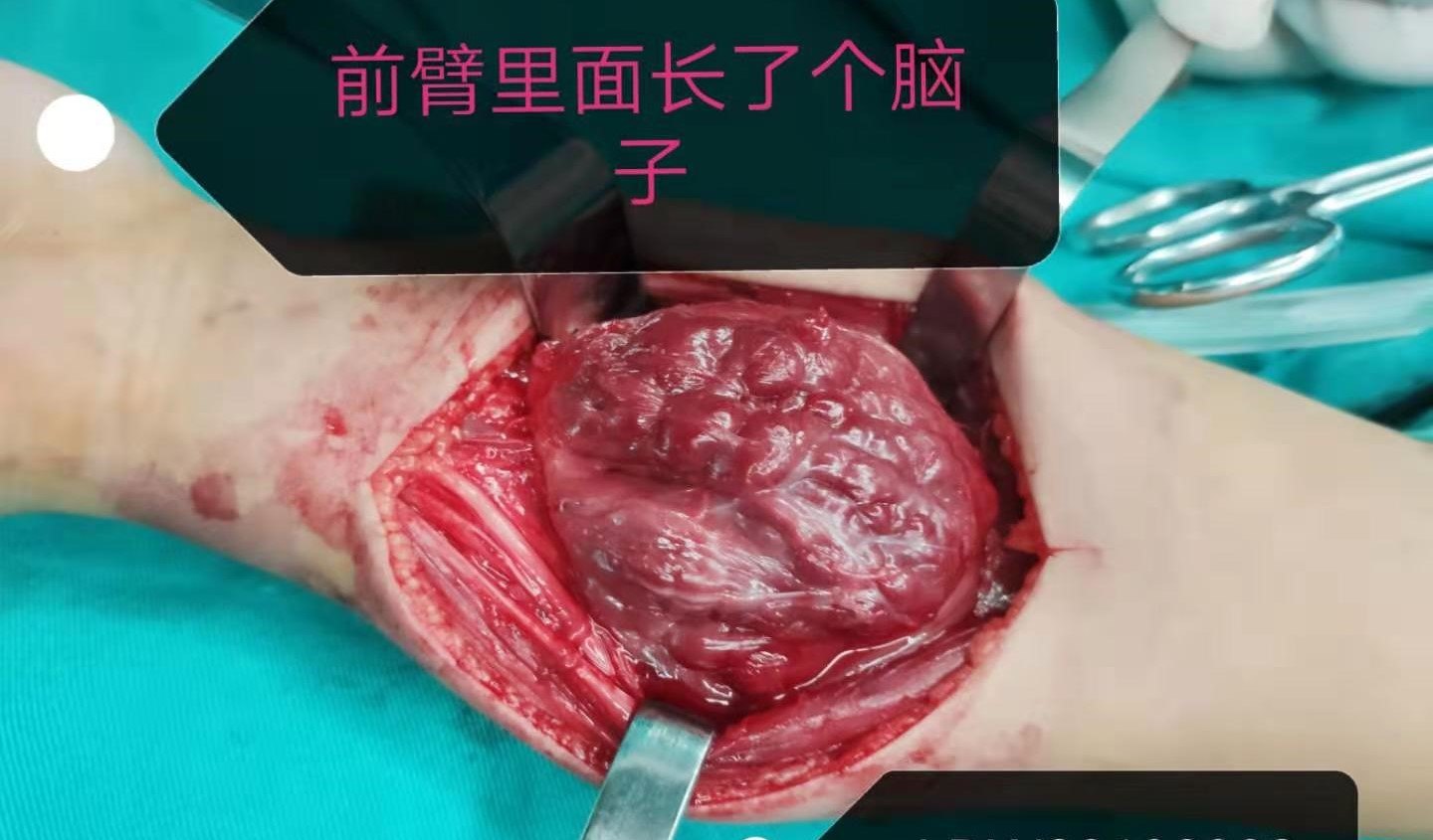 勃起硬硬度看图片_看看硬度_看一看硬度