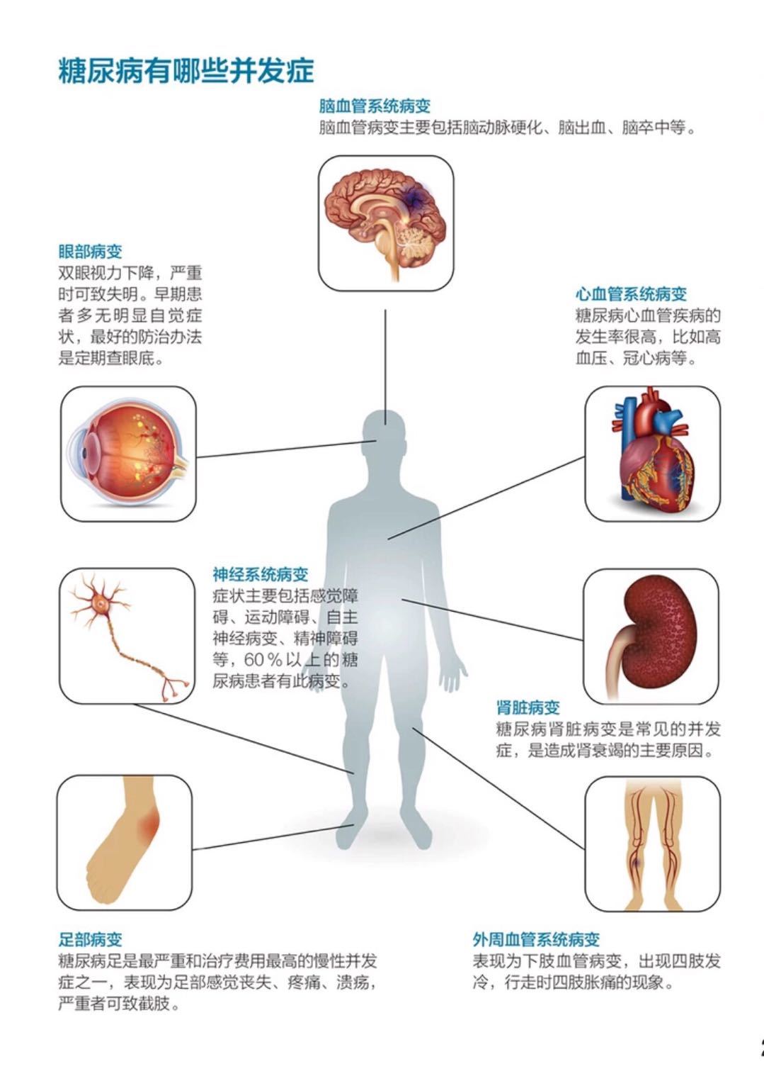 【認識糖尿病】掌握兩個