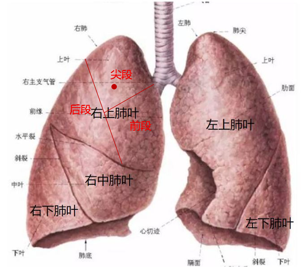 肺叶左二右三图图片