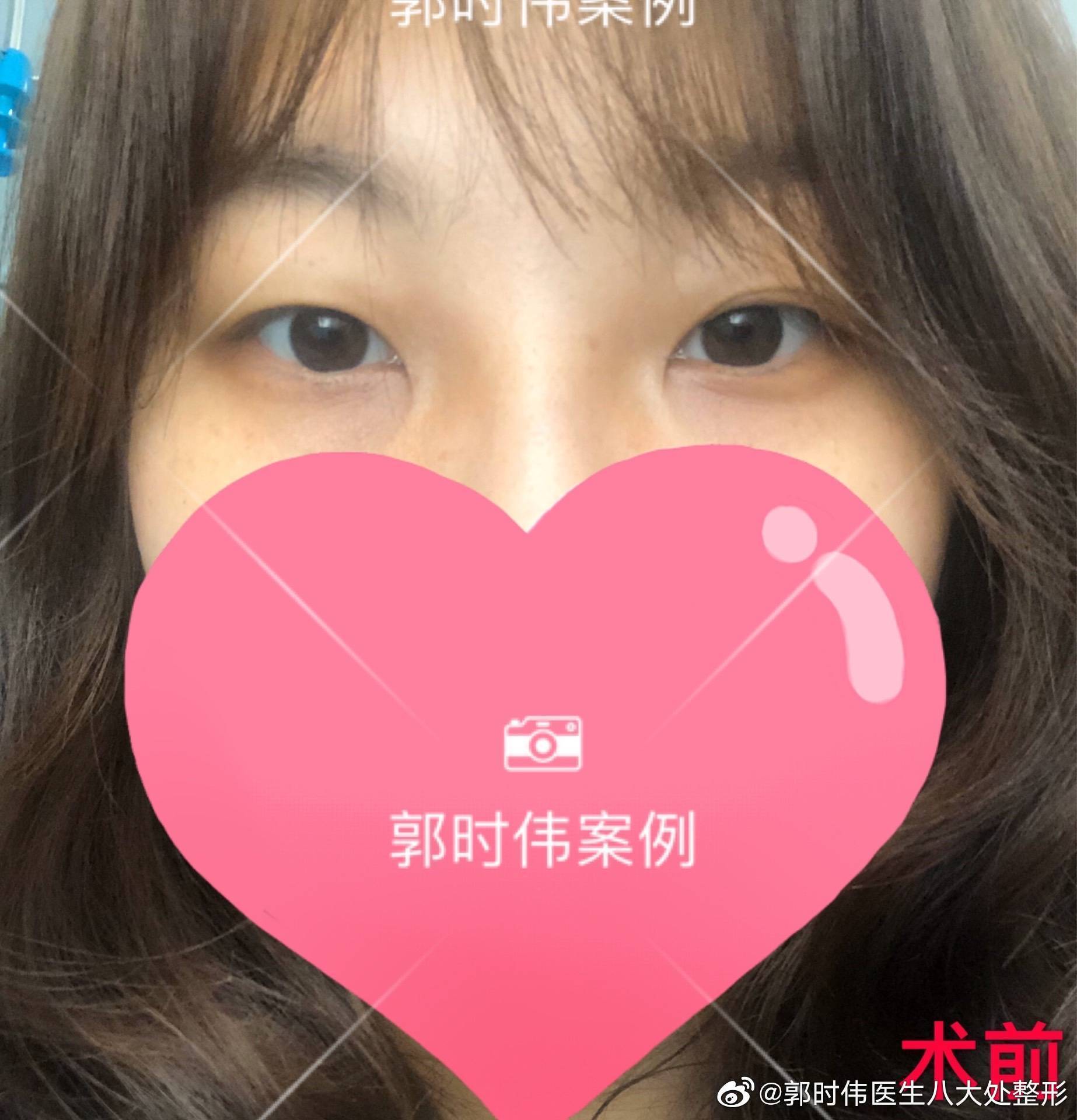 八大處整型醫(yī)院快速就醫(yī)黃牛掛號說到必須做到的簡單介紹