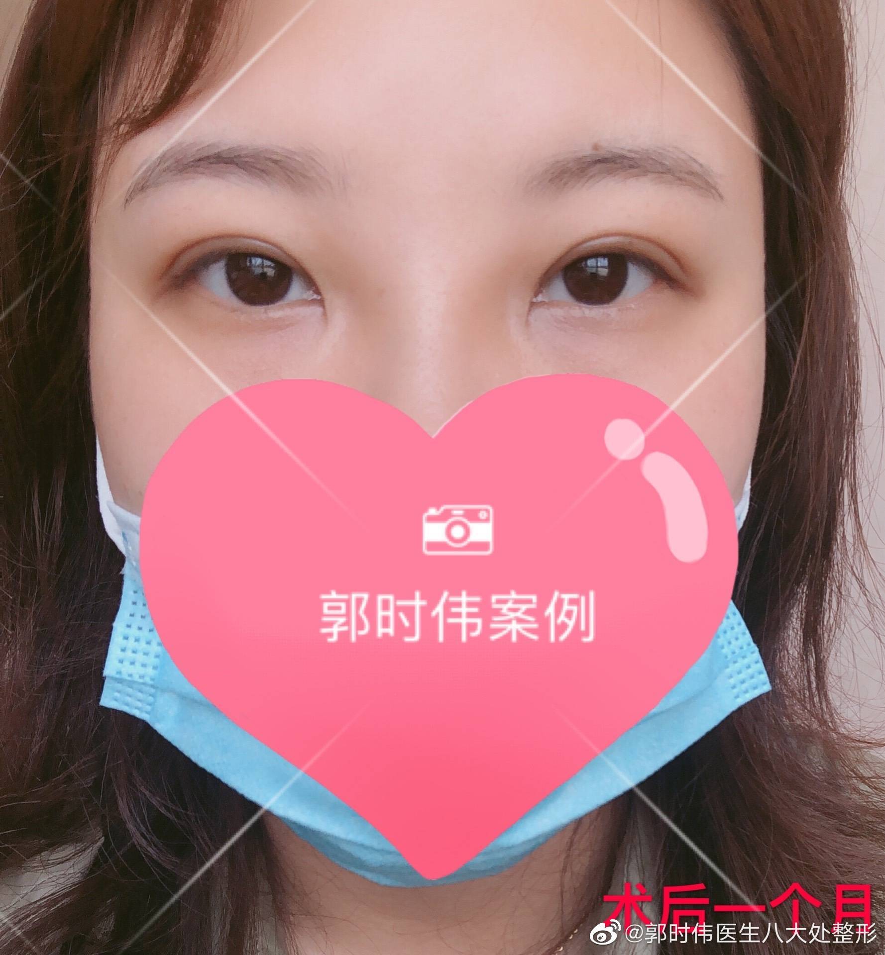 八大处整型医院黄牛票贩子，号贩子挂号-的简单介绍