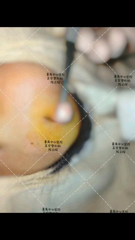 視頻封面